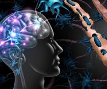 Σκλήρυνση Κατά Πλάκας