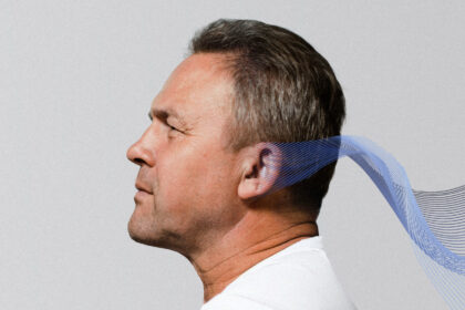 Πως αντιμετωπίζουμε την πάρεση προσωπικού νεύρου