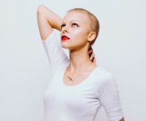 γυναίκα που σώθηκε από λέμφωμα Hodkin's προσδόκιμο ζωής