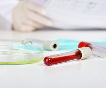 Εχω αναιμία τι να κανω μεσογειακή αναιμία