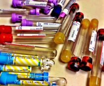 αιματοκρίτης