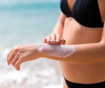 Ηλιακή κνίδωση - Οι αλλεργίες του καλοκαιριού