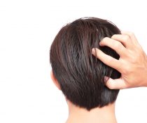 άντρας έχει φαγούρα από πιτυρίδα