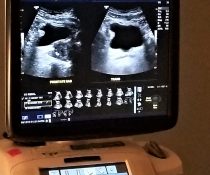 ανεπάρκεια