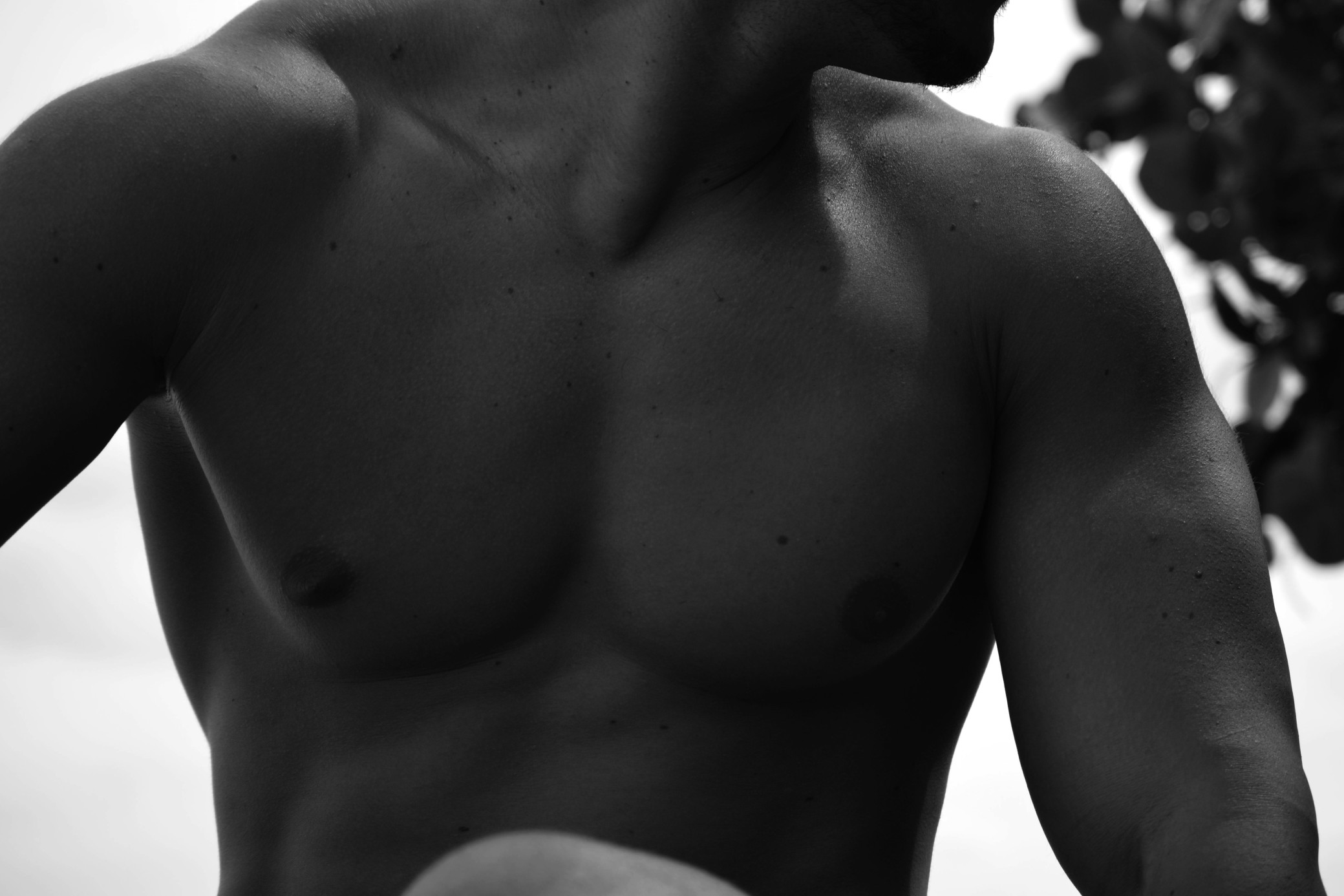 γυναικομαστία