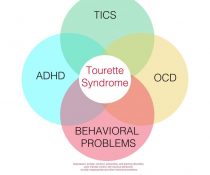 Tourette