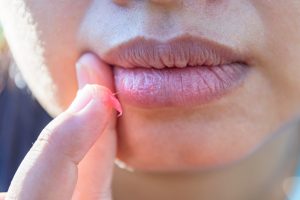 lip balm