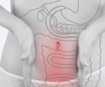 εκκολπωματίτιδα