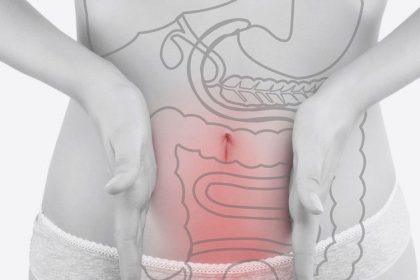 εκκολπωματίτιδα