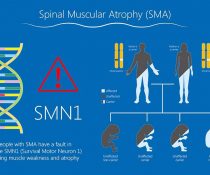 SMA