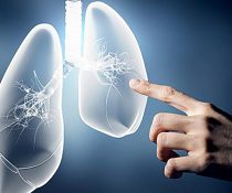 γνωμοδότηση