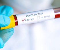 test covid