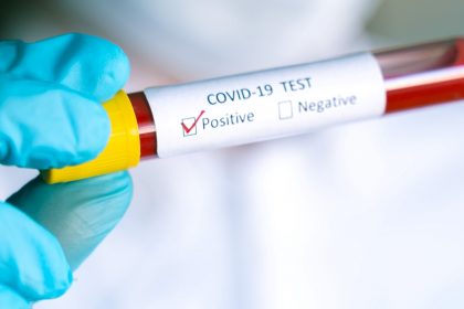 Κορονοϊός: 168 νέα κρούσματα στη χώρα – Περιορισμός της αύξησης