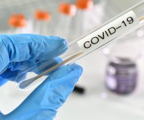 SARS-CoV-2