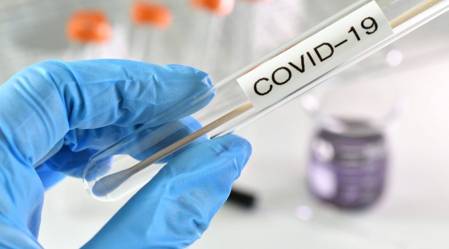 SARS-CoV-2
