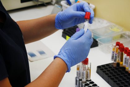 rapid test koronoios