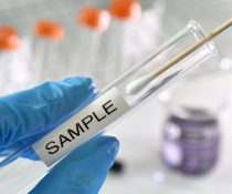 ΕΟΔΥ RAPID TEST