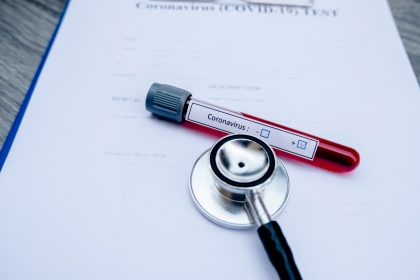 306 nea krousmata covid19 test