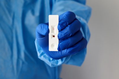 test koronoiou ΕΟΔΥ δωρεάν