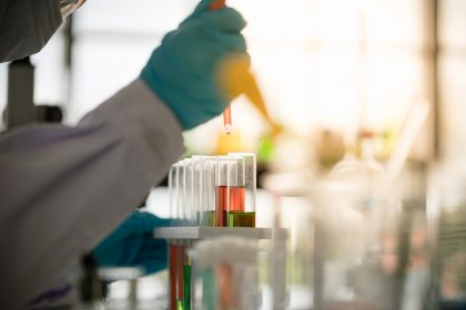 Τα αντισώματα κατά του Covid-19 στον οργανισμό μειώνονται σχετικά γρήγορα