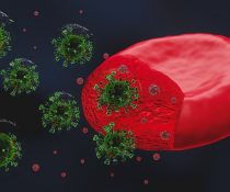 thromvosis