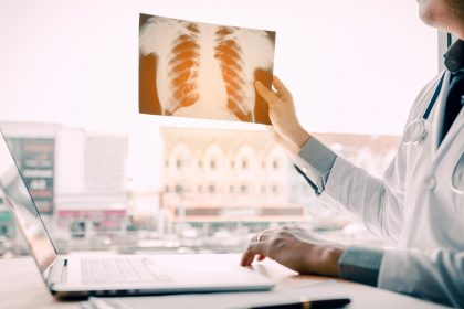 Πνευμονική Υπέρταση: Πρόγνωση και προσδόκιμο ζωής
