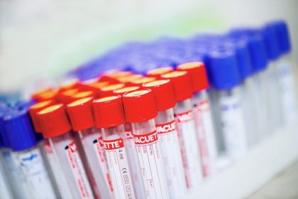 Φιαλίδια με ομάδες αίματος