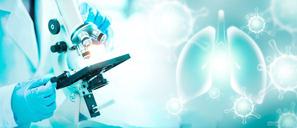 O Covid-19 σε μικροβιακή ανάλυση