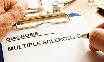 Multiple sclerosis