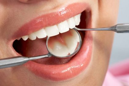 Καρκίνος στόματος - Εξέταση δοντιών στον οδοντίατρο