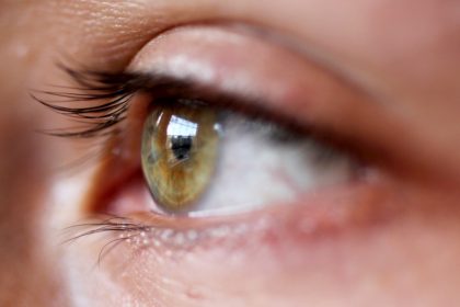 υπερμετρωπία ενήλικες πράσινο μάτι