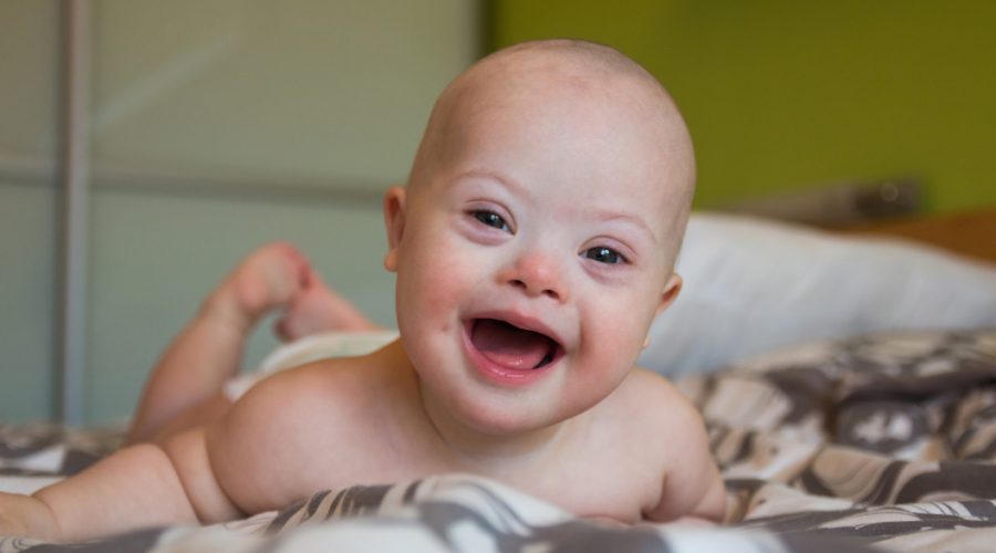 Μωρό με σύνδρομο down