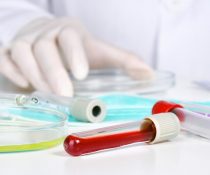 ελπιδοφόρα θεραπεία roche regeneron