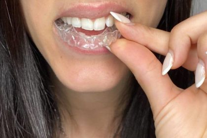 Διαφανείς νάρθηκες: Η επανάσταση στην ορθοδοντική