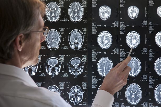 Γεροντική άνοια: Νευρολόγος εξετάζει τον εγκέφαλο 