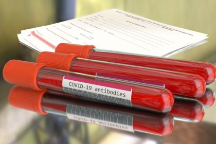τεστ αντισωμάτων covid-19