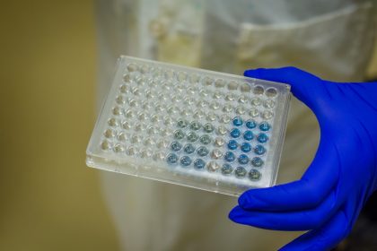 Η πρώιμη χορήγηση μονοκλωνικών αντισωμάτων μειώνει τη θνησιμότητα του Covid-19