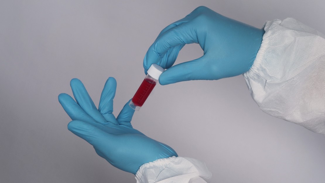 τεστ μετά τον εμβολιασμό