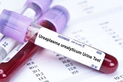 Ουρεόπλασμα - Θεραπεία