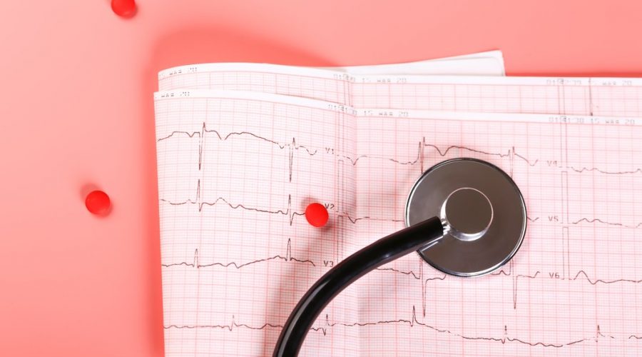 Αρρυθμία: Πότε αυξάνει ο κίνδυνος στις γυναίκες; καρδιογράφημα