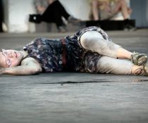 σύνδρομο Down
