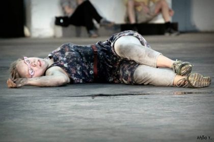 σύνδρομο Down