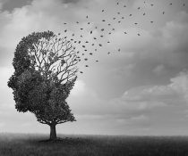 Alzheimer
