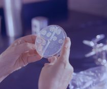 Η αναπνοή συμβάλλει περισσότερο από ό,τι ο βήχας στην εξάπλωση της φυματίωσης