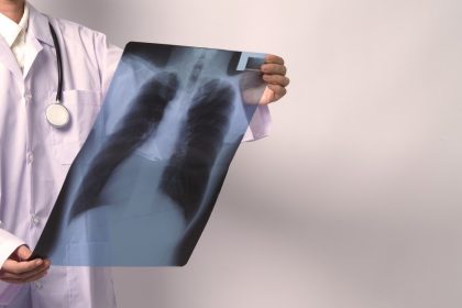 φυματίωση θάνατοι