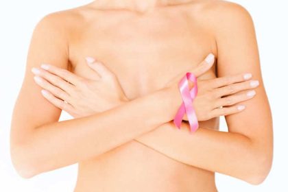 καρκίνου του μαστού
