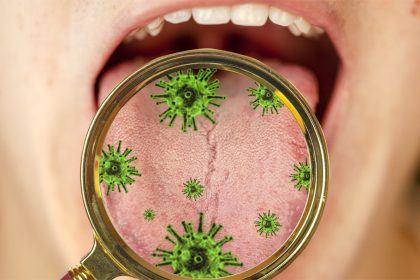 Covid-19-τσίχλα