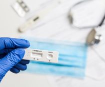 PCR TEST