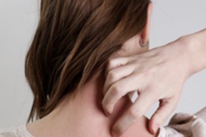 Έρπης ζωστήρας ηλικία