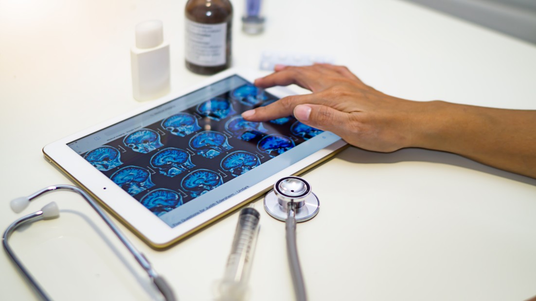 Μυστηριώδη νευροεκφυλιστική ασθένεια πλήττει νέους ανθρώπους